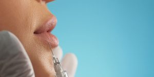Lippenvergrößerung